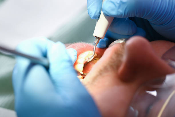 Best Urgent Tooth Repair  in Lucasville, OH